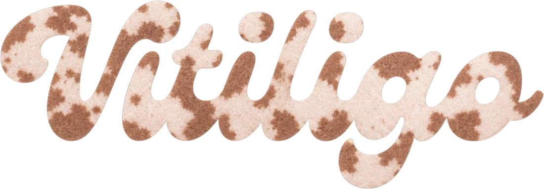 Vitiligo